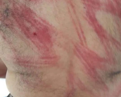 Efr&icirc;n&hellip; gr&ucirc;p&ecirc;n &ccedil;ekdar welatiy&ecirc;n Kurd eşkence didin